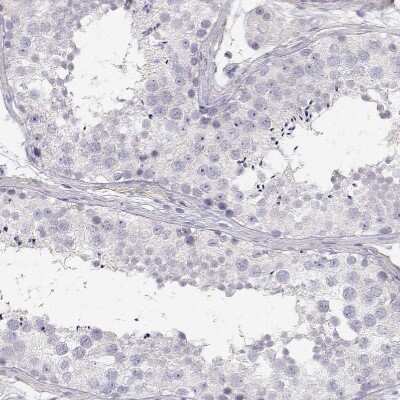 Immunohistochemistry-Paraffin: Protocadherin 21 Antibody [NBP1-92296]