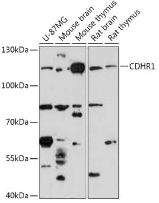 Western Blot: Protocadherin 21 AntibodyAzide and BSA Free [NBP2-94419]