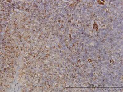 Immunohistochemistry-Paraffin: Protocadherin-8 Antibody (6A8) [H00005100-M01]