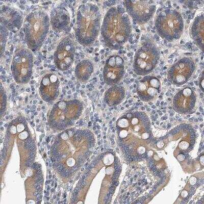 Immunohistochemistry-Paraffin: Protocadherin-8 Antibody [NBP1-88850]