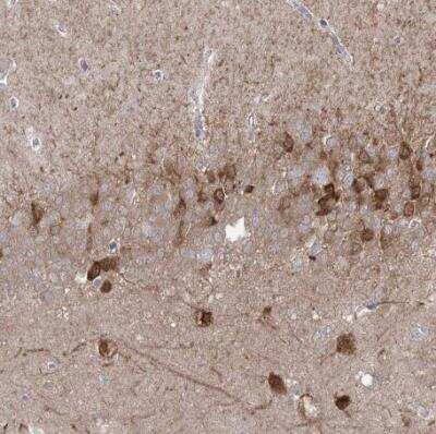 Immunohistochemistry-Paraffin: Protocadherin alpha 1 Antibody [NBP1-86297]
