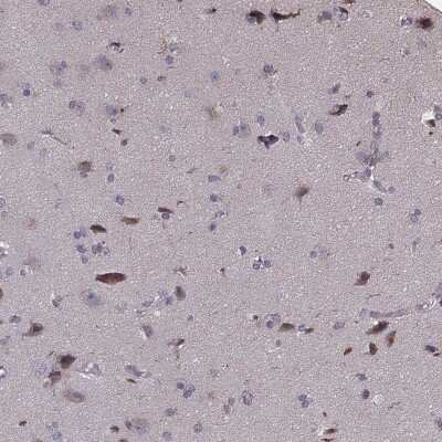 Immunohistochemistry-Paraffin: Protocadherin alpha 4 Antibody [NBP2-57952]