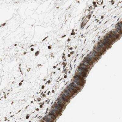 Immunohistochemistry: Protocadherin beta 10 Antibody [NBP1-87575]