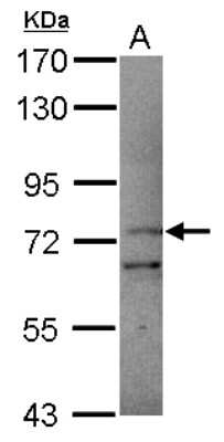 Western Blot: Protocadherin beta 11 Antibody [NBP2-19962]