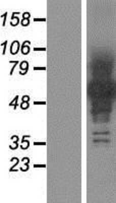 Western Blot: Protocadherin beta 12 Overexpression Lysate [NBP2-06774]