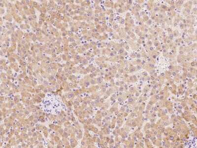 Immunohistochemistry-Paraffin: Protocadherin beta 3 Antibody [NBP2-97447]