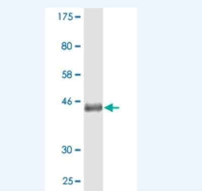 Western Blot: Protocadherin gamma C3 Antibody (3F10) [H00005098-M01]