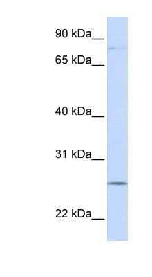 Western Blot: Protocadherin gamma C3 Antibody [NBP1-59233]