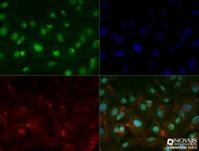 Immunocytochemistry/ Immunofluorescence: Prox1 Antibody (5G10) - Azide and BSA Free [NBP2-80920]