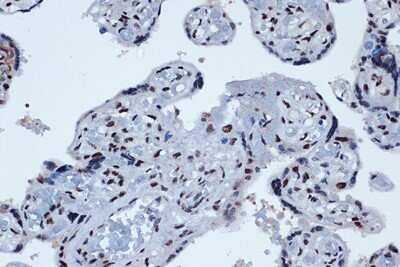 Immunohistochemistry-Paraffin: Prox1 Antibody (9I9A7) [NBP3-16739]