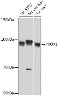 Western Blot: Prox1 Antibody (9I9A7) [NBP3-16739]