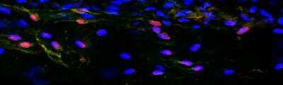 Immunocytochemistry/ Immunofluorescence: Prox1 Antibody [NBP1-18605]