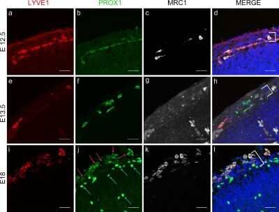 Immunocytochemistry/ Immunofluorescence: Prox1 Antibody [NBP1-18605]