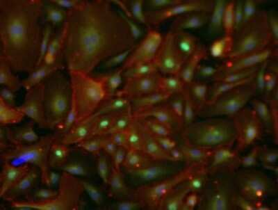 Immunocytochemistry/ Immunofluorescence: Prox1 Antibody [NBP1-18606]