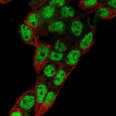 Immunocytochemistry/ Immunofluorescence: Prox1 Antibody [NBP2-55154]