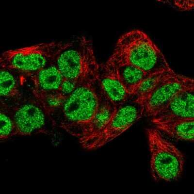 Immunocytochemistry/ Immunofluorescence: Prox1 Antibody [NBP2-55222]