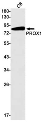 Western Blot: Prox1 Antibody (S02-8H5) [NBP3-19747]