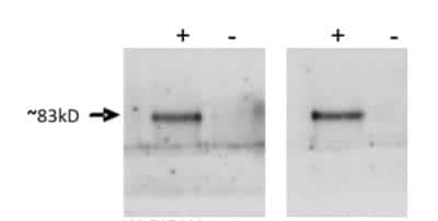 Western Blot: Prox1 Antibody [NBP1-18605]