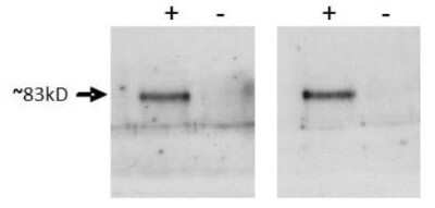 Western Blot: Prox1 Antibody [NBP1-18606]