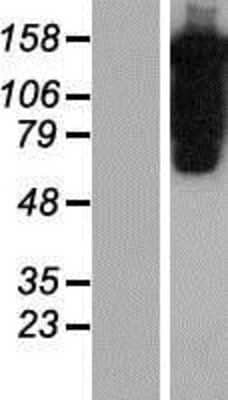 Western Blot: PUM1 Overexpression Lysate [NBP2-10310]