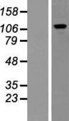 Western Blot: PUM2 Overexpression Lysate [NBP2-10289]