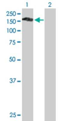 Western Blot: Puratrophin-1 Antibody [H00025894-B01P]