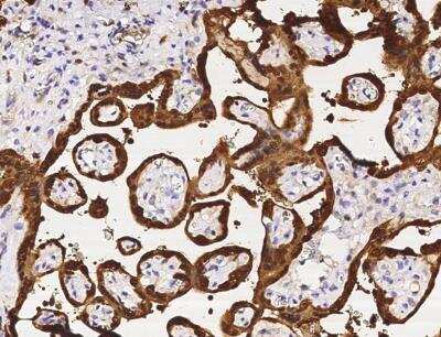 Immunohistochemistry-Paraffin: Purine Nucleoside Phosphorylase/PNP Antibody (001) [NBP2-90052]