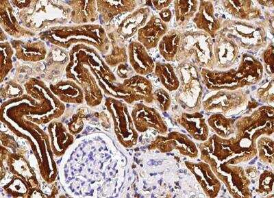 Immunohistochemistry-Paraffin: Purine Nucleoside Phosphorylase/PNP Antibody (001) [NBP2-90052]