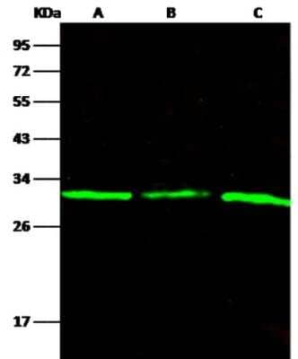 Western Blot: Purine Nucleoside Phosphorylase/PNP Antibody (103) [NBP2-90053]