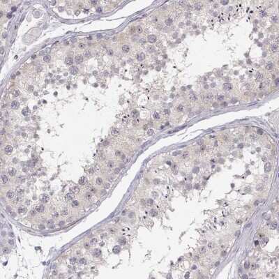 Immunohistochemistry-Paraffin: Purine Nucleoside Phosphorylase/PNP Antibody [NBP1-82541]