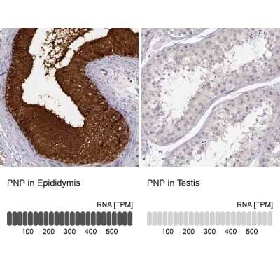 Immunohistochemistry-Paraffin: Purine Nucleoside Phosphorylase/PNP Antibody [NBP1-82541]