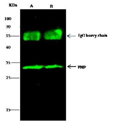 Immunoprecipitation: Purine Nucleoside Phosphorylase/PNP Antibody [NBP2-99935]