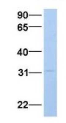 Western Blot: Purine Nucleoside Phosphorylase/PNP Antibody [NBP1-54353]