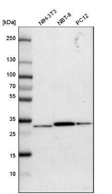 Western Blot: Purine Nucleoside Phosphorylase/PNP Antibody [NBP1-82541]