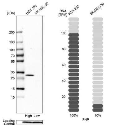 Western Blot: Purine Nucleoside Phosphorylase/PNP Antibody [NBP1-82541]