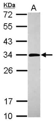 Western Blot: Purine Nucleoside Phosphorylase/PNP Antibody [NBP2-19603]