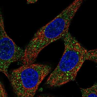 Immunocytochemistry/ Immunofluorescence: Puromycin-sensitive aminopeptidase/NPEPPS Antibody [NBP2-13669]