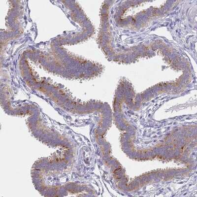 Immunohistochemistry: Puromycin-sensitive aminopeptidase/NPEPPS Antibody [NBP2-13669]