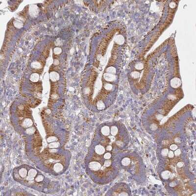 Immunohistochemistry-Paraffin: Puromycin-sensitive aminopeptidase/NPEPPS Antibody [NBP2-13669]