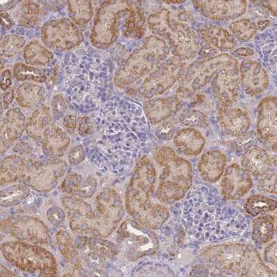 Immunohistochemistry-Paraffin: Puromycin-sensitive aminopeptidase/NPEPPS Antibody [NBP2-13669]