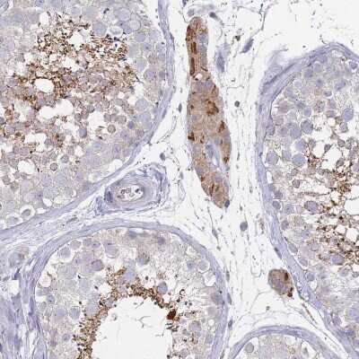 Immunohistochemistry-Paraffin: Puromycin-sensitive aminopeptidase/NPEPPS Antibody [NBP2-13669]