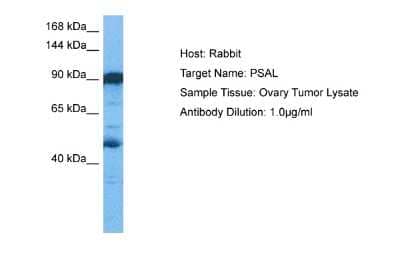 Western Blot: Puromycin-sensitive aminopeptidase/NPEPPS Antibody [NBP2-88103]