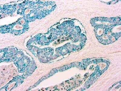 Immunohistochemistry-Paraffin: Purple Hematoxylin Solution [NBP3-12176]