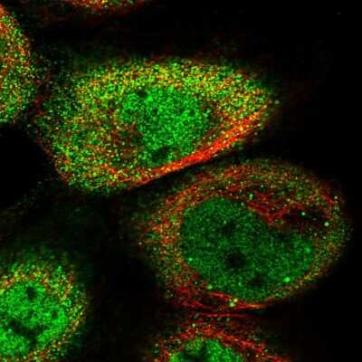 Immunocytochemistry/ Immunofluorescence: Pygopus-1 Antibody [NBP1-86218]