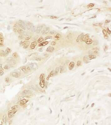 Immunohistochemistry: Pygopus-1 Antibody [NBP1-42665]