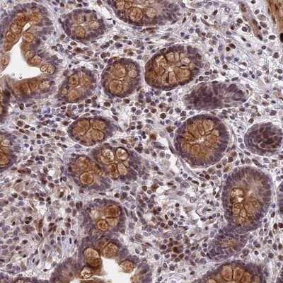 Immunohistochemistry-Paraffin: Pygopus-1 Antibody [NBP1-86218]