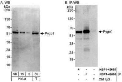 Western Blot: Pygopus-1 Antibody [NBP1-42666]