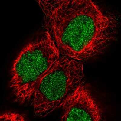 Immunocytochemistry/ Immunofluorescence: Pygopus-2 Antibody [NBP1-87548]