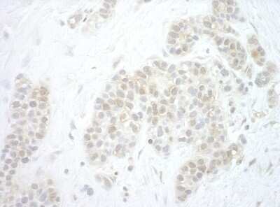 Immunohistochemistry: Pygopus-2 Antibody [NBP1-46172]