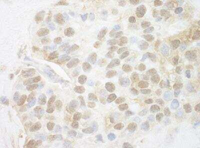 Immunohistochemistry-Paraffin: Pygopus-2 Antibody [NBP1-46171]